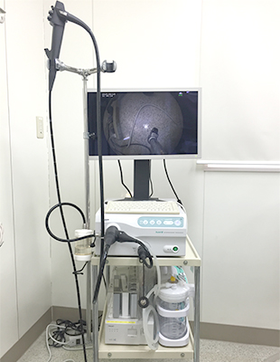 内視鏡検査と炎症性腸疾患